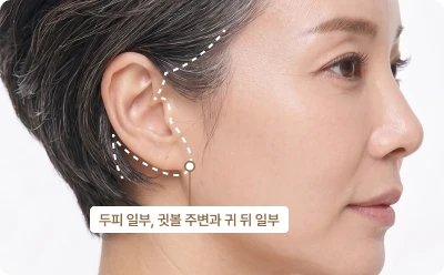 일반 거상 일러스트