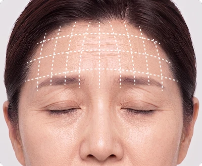 이마·눈썹·눈꺼풀 상태 진단